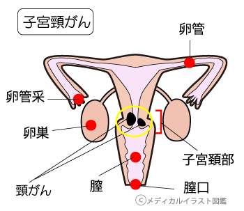 子宮部位説明図